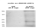 Mouse mAb Against Human Neutrophil Elastase