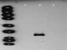Mouse mAb Against Human Neutrophil Elastase
