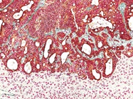 Tips to Get the Most Out of IHC Experiments