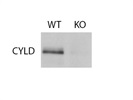 Detection Of CYLD Protein Expression