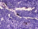 CD62E (E-selectin) Antibody