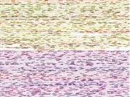 Optimizing Your Linked-Read Genome and Exome Analyses: 4 Practical Considerations
