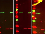 Automated Immunodetection Systems
