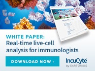 Real-Time Live-Cell Analysis for Immunologists