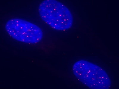 stem cells