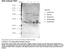 ADO Antibody Works in Western Blot