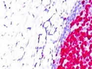 Tips for Successful IHC Staining