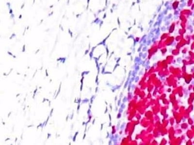  Tips for Successful IHC Staining