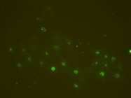 Good Antibody