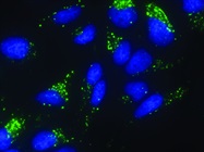 Mastering Cell-Based Screening