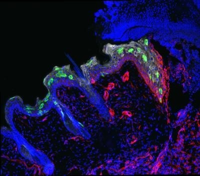 immune cells