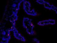 Antibody Stains Gamma-Delta T Cells In The Gut Very Well