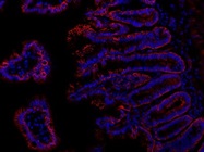 The Antibody Stains beta Catenin Very Well