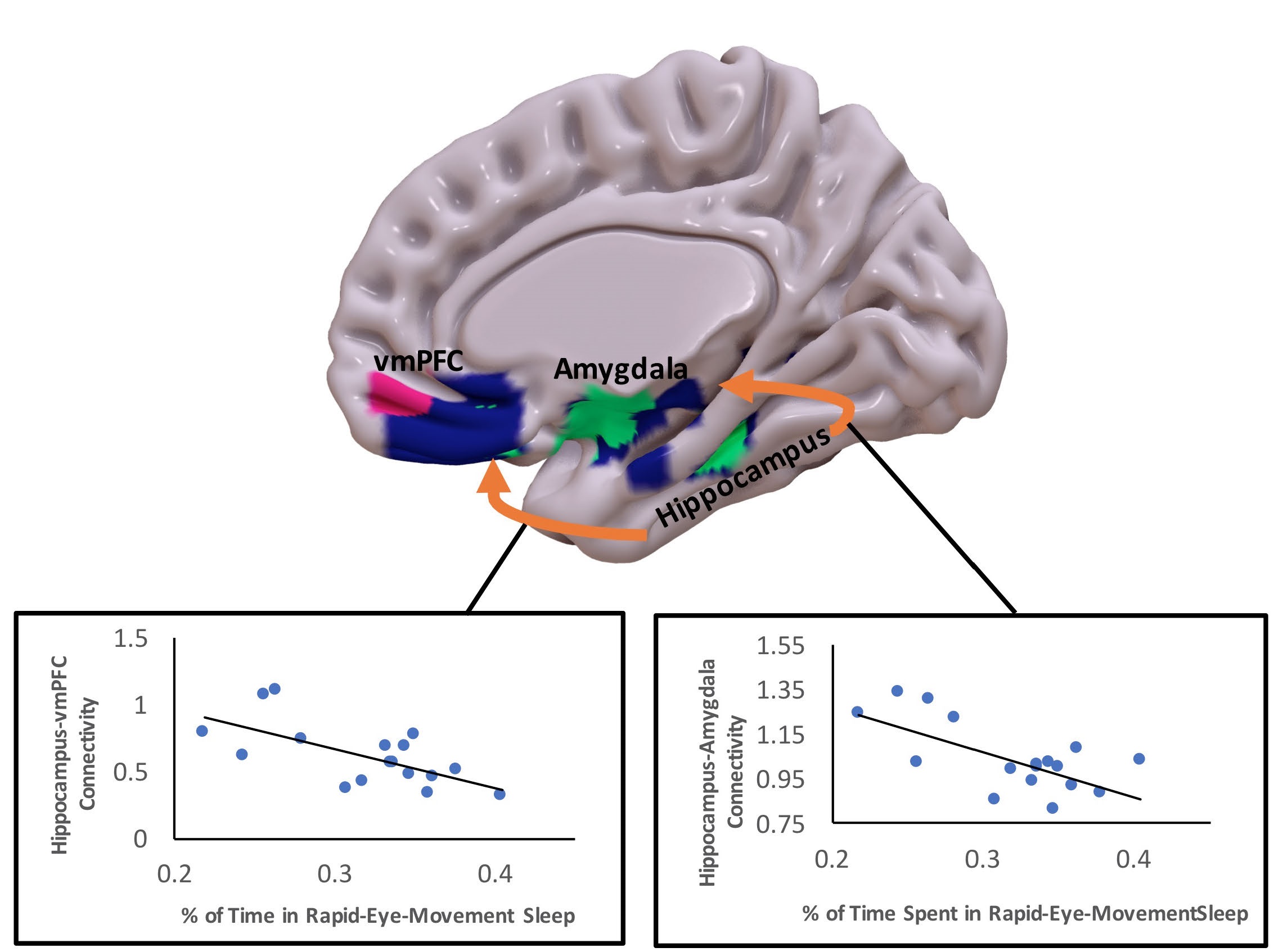 Brain Sleep Fear