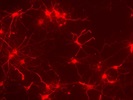 Immunocytochemistry In Primary Neurons