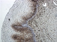 Avoid Ambiguity with Our POLYVIEW® PLUS IHC Detection Reagents