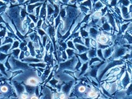 Cell Culture Media Key to Bioprocess Efficiencies