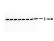 Affordable beta Actin Antibody
