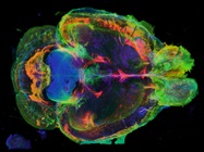 New Tools for a Deeper Look into the Brain