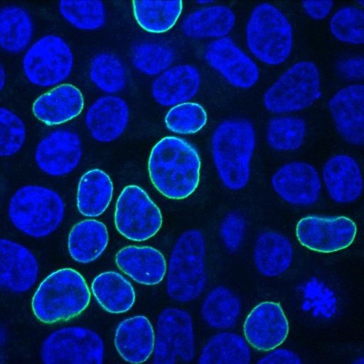 CRISPR