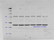 beta-Actin Antibody for Western Blot