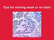 Watch Video: Immunohistochemistry Tips and Tricks for Weak or No Stain
