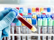 Liquid Biopsies Move In on Tissue Biopsies for Cancer Testing