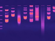 Gel Documentation Details