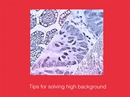 Watch Video: Immunohistochemistry Tips and Tricks for High Background