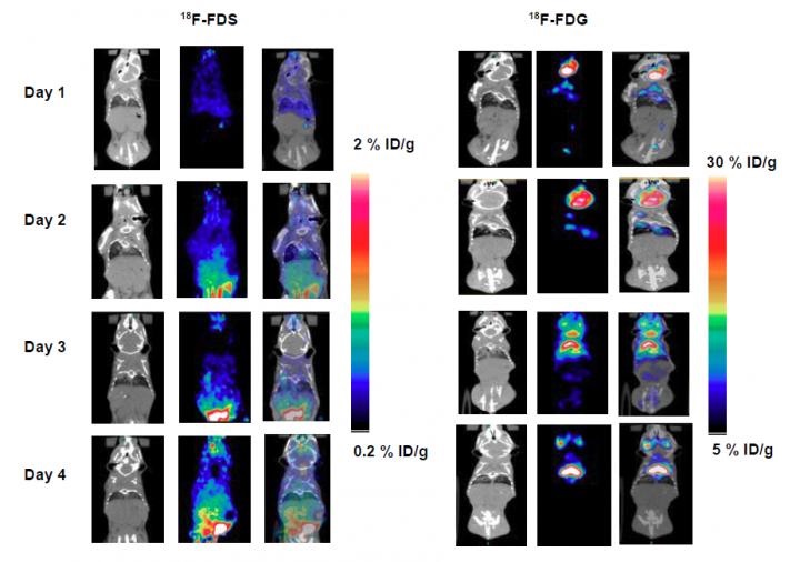 PET/CT scans using new radiotracer
