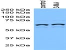 Phospho-p70 S6 Kinase Antibody