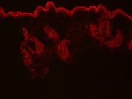 Mouse Skin LRP6 Immunofluorescence Staining