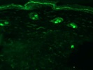 Mouse Skin PEDF R Immunofluorescence Staining