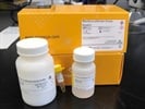 Renilla Luciferase Assay System