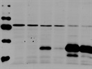 LCN2 (D4M8L) Rabbit Antibody