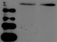 Good Anti-CBL Antibody from Abcam