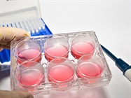 Take the Biocompare Quiz: Cryopreservation, Cell Growth Surfaces, and More