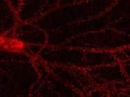 Good Immunofluorescence Staining