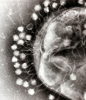 image of bacteriophage infecting a bacterial cell