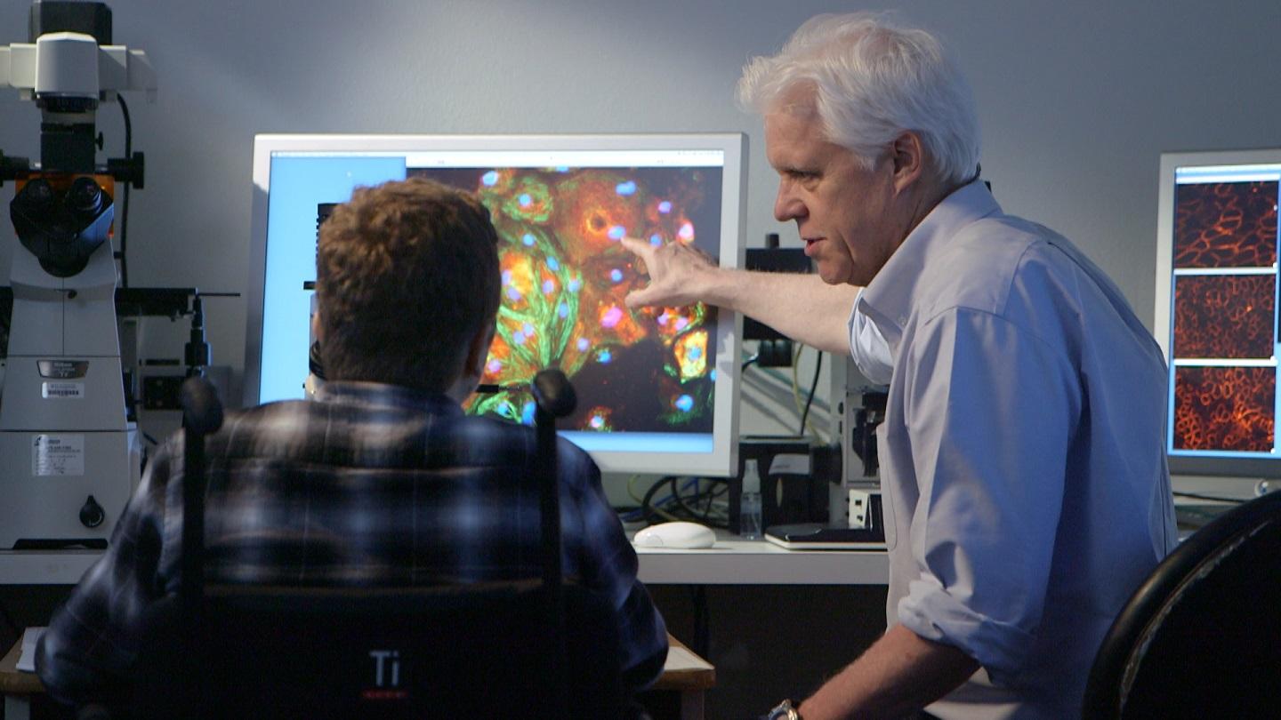 doctor shows duchene muscular dystrophy patient red blood cells