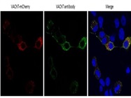 Perfect Anti-VAChT Antibody