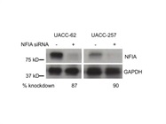 Lipofectamine RNAiMAX