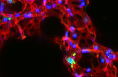 iNKT cells