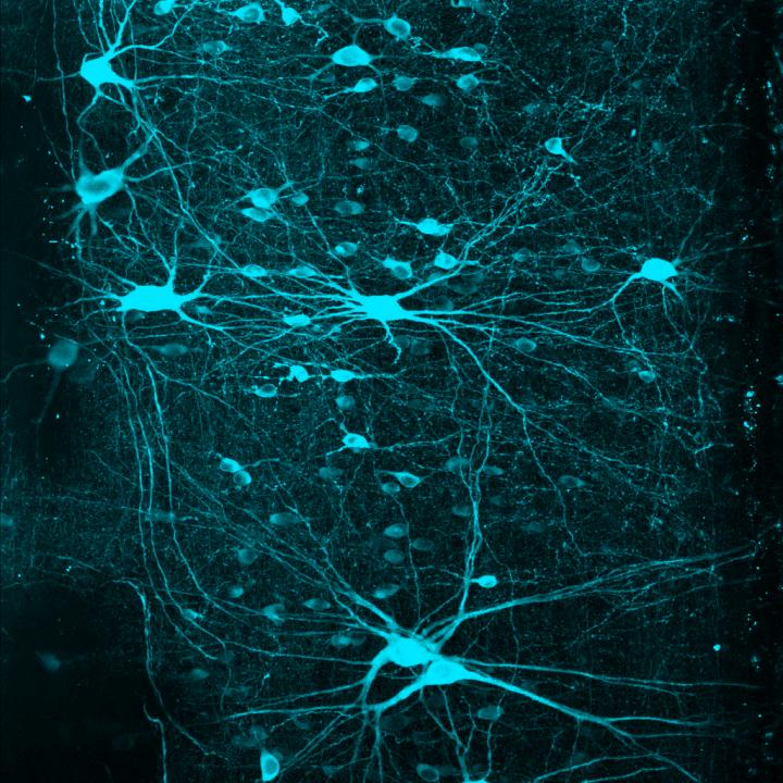 V2a neurons