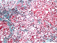 What to Consider When Choosing Apoptotic Assays
