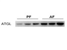 Adipose Triglyceride Lipase Western Blot Antibody