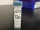 Time Course Effect Of Chemoattractant On HER2 Expression