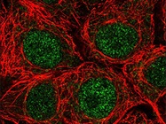 Tips for Successful Immunofluorescent Staining