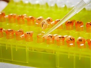 Sample Prep for Mass Spec
