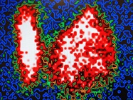 Digital Transformation of Pathology